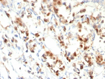 Progesterone Receptor Antibody