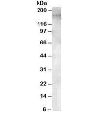 Western blot testing of human testis lysate with APA antibody at 1ug/ml. Predicted molecular weight ~109/160 kDa (unmodified/glycosylated).