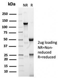 ACE Antibody / Angiotensin I Converting Enzyme