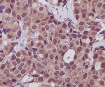 HSP70 Antibody / HSPA1A / HSPA1B