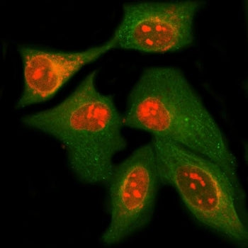Immunofluorescent staining of FFPE human HeLa cells with MPHOSPH10 antibody (red) and Beta Tubulin m