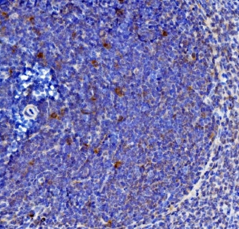 IL-21 Antibody