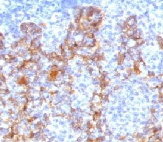 Acidic Cytokeratin Antibody