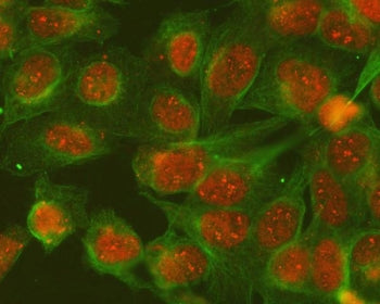 SGTA Antibody / SGT1
