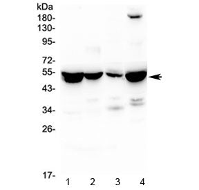 ASL Antibody / Adenylosuccinate Lyase