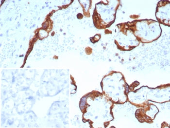 IHC staining of FFPE human placental tissue with Acidic Cytokeratin antibody (clone rKRTL/8751). Ins