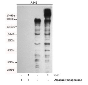 Phosphotyrosine Antibody