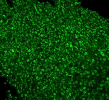 PTBP1 Antibody
