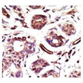 Ubiquitin-protein ligase E3A Antibody / UBE3A