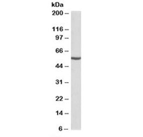 Western blot testing of mouse kidney lysate with ALDH6A1 antibody at 0.1ug/ml. Predicted molecular w