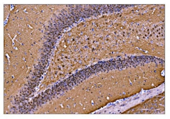 CAMKIV Antibody