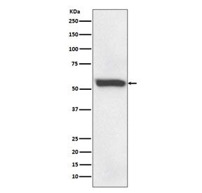 Western blot testing of human fetal liver with 58K Golgi protein antibody. Predicted molecular weight ~58 kDa.