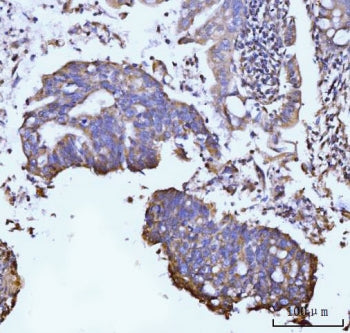Glutamine Synthetase Antibody / GLUL