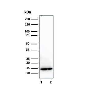 Western blot testing of human 1) LNCaP and 2) PC3 cell lysates using MIF antibody (clone MIF/3489). 