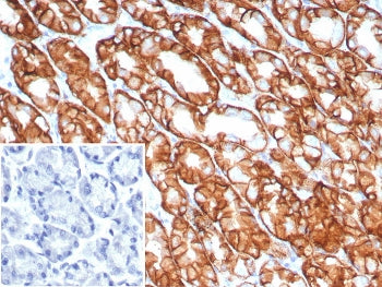 Claudin18.2 Antibody