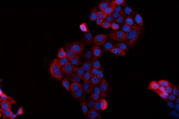 Immunofluorescent staining of FFPE human A431 cells with BAG2 antibody (red) and DAPI nuclear stain 
