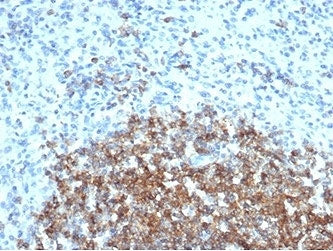 IHC staining of FFPE human spleen tissue with CD35 antibody (clone CR1/6377) at 2ug/ml. HIER: boil t