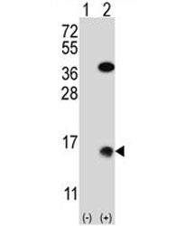 Western blot analysis of SUMO2 antibody and 293 cell lysate (2 ug/lane) either nontransfected (Lane 