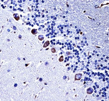 IHC testing of FFPE mouse cerebellum tissue with CKI-gamma 3 antibody. HIER: steam section in pH6 ci