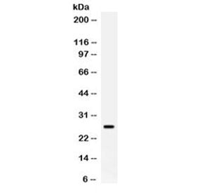 Western blot testing of human placenta lysate with APOA1 antibody. Predicted molecular weight ~30 kD