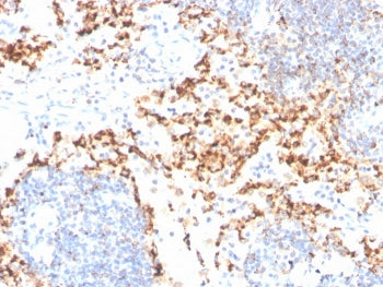 IHC staining of FFPE human tonsil with TIM3 antibody. HIER: boil tissue sections in pH 9 10mM Tris w
