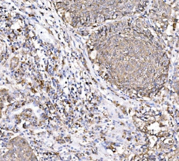 PAK1 Antibody