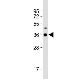 Western blot testing of rat spleen tissue lysate with DNASE1L3 antibody. Predicted molecular weight 