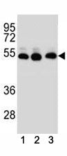 TUBB2B antibody western blot analysis of (1) human HepG2, (2) human HeLa, (3) human MDA-MB-231 cell 