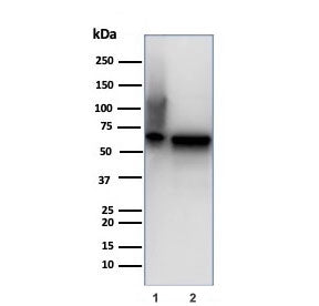 Western blot testing of human 1) Hep-2 and 2) HeLa cell lysate using recombinant HSP60 antibody (clo