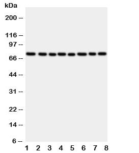 Western blot testing of CYPOR antibody and rat samples: 1. ovary; 2. lung; 3. testis; 4. spleen; and human samples 5. A549; 6. HeLa; 7. SKOV; 8. MCF-7 cell lysate. Predicted/observed molecular weight: ~77 kDa.