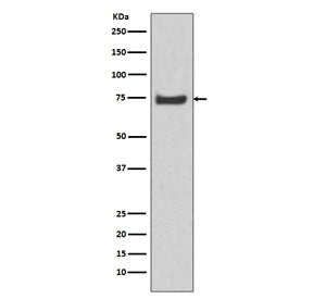 Western blot testing of human U-87 MG cell lysate with HSPA12A antibody. Expected molecular weight ~