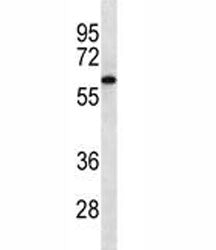 CAMKK2 Antibody