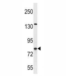 CPT1B Antibody