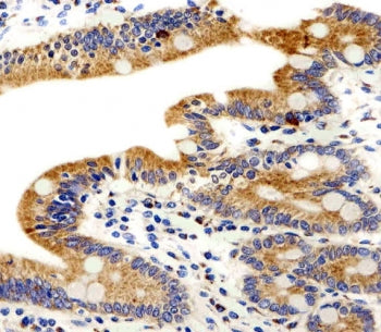 ADRA1D Antibody / Alpha Adrenergic Receptor 1d