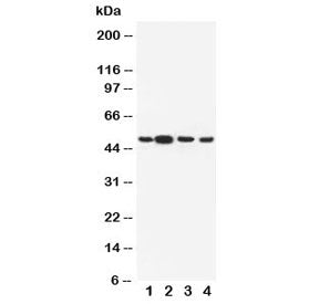 Western blot testing of Dopamine Receptor D3 antibody and Lane 1: rat testis; 2: rat brain; 3: human