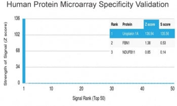 Analysis of HuProt(TM) microarray containing more than 19,000 full-length human proteins using Uropl
