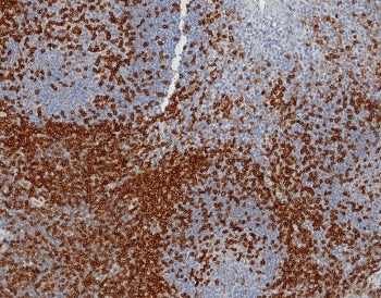 CD45RA Antibody (Leukocyte marker)