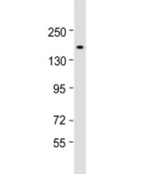 Western blot testing of human HeLa cell lysate with CHD5 antibody at 1:2000. Predicted molecular wei