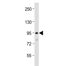 TGFBR3 Antibody / TGF beta Receptor III (N-Terminal Region)