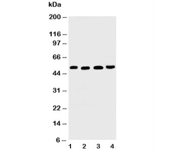 TRAIL R2 Antibody (DR5)
