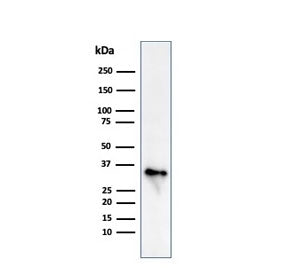Western blot testing of human Raji cell lysate with CLIP antibody (clone CLIP/813). Expected molecul