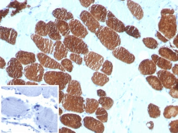 MYH7 Antibody / Myosin 7