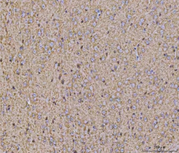 Calcineurin A Antibody