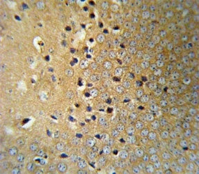 VHL Antibody
