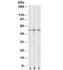 ATP5B Antibody