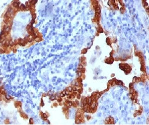 KRT8 Antibody / Cytokeratin 8