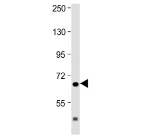 IL1RAP Antibody (C-Terminal Region)