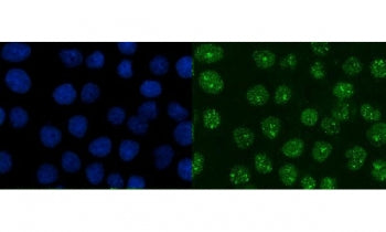XRCC1 Antibody / X-ray repair cross-complementing protein 1