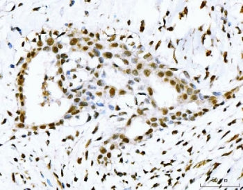 TP53BP1 Antibody / TP53-binding protein 1