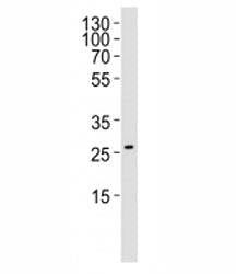 Western blot analysis of lysate from RD cell line (human rhabdomyosarcoma) using NRG1 antibody at 1: